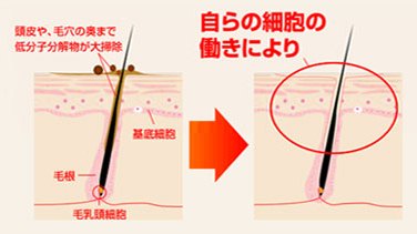 �T�����B�I�@M-1�~�X�g