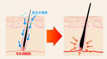 �T�����B�I�@M-1�~�X�g