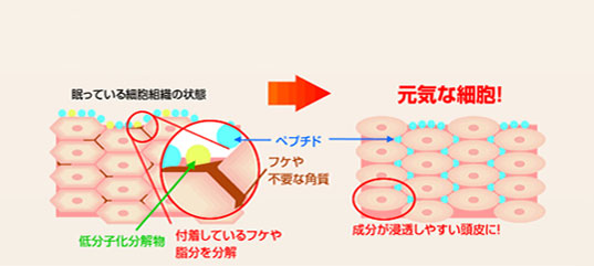 �T�����B�I�@M-1�~�X�g